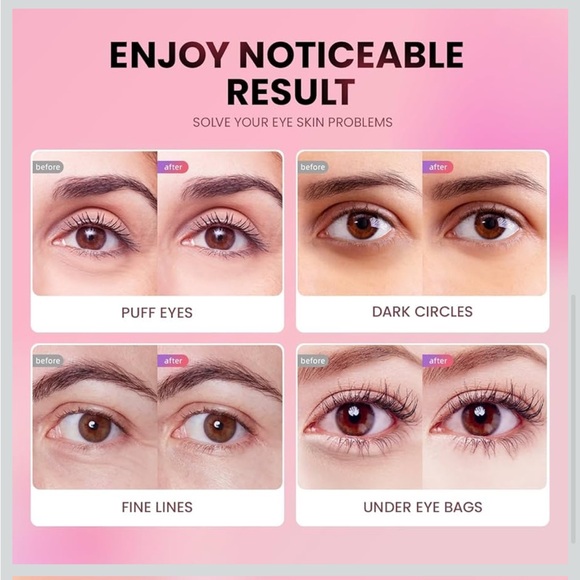 Pink Glitter Eye Mask - Hydrating Under-Eye Patches (12 Pairs) - Picture 6 of 9